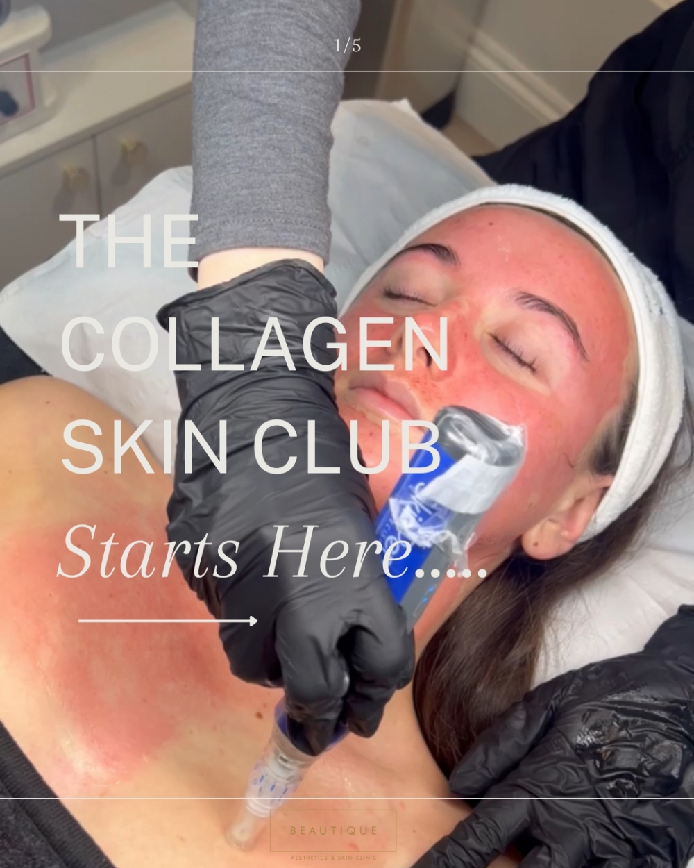 Collagen club